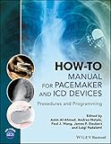 How-to Manual for Pacemaker and ICD Devices: Procedures and Programming