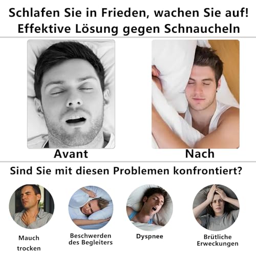 DOHUG Snore Splint, Adjustable Bite Splint Against Snoring and Crunching - Anti Snoring Snoring Stopper - Anti-Snoring Mouth Guard - Improves Sleep Quality (White Medium)