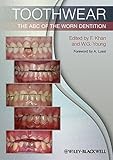 Toothwear: The ABC of the Wo Dentition-Wow! eBook