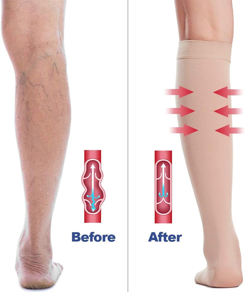 Beister Medical Closed Toe Knee High Calf Compression Socks for Women & Men - Image 5