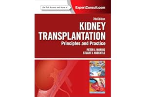 Kidney Transplantation - Principles and Practice: Expert Consult - Online and Print (Morris,Kidney Transplantation)