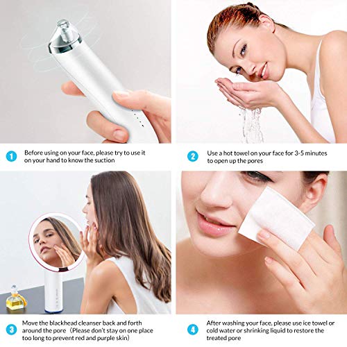 Blackhead Remover, Apolol Blackhead Vacuum Suction Removal, Acne Extractor Tool Set, Skin Facial Pore Cleaner, Comedo Microdermabrasion Exfoliating Machine for Women & Men    - Thumbnail 6