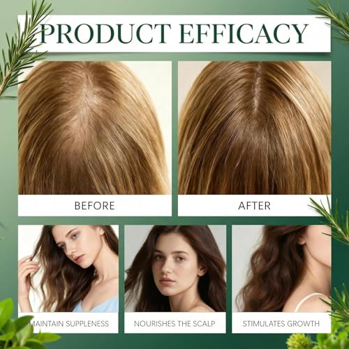 Champú De Romero Para El Crecimiento Del Cabello, 100ml Champú Orgánico De Romero Para La Caída Del Cabello, Fortalecedor Y Nutritivo Con Queratina Hidrolizada Para Hombres Y Mujeres