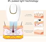 Ubcwin IPL Hair Removal Device, 500,000 Flashes, 5 Energy Levels, White view 7
