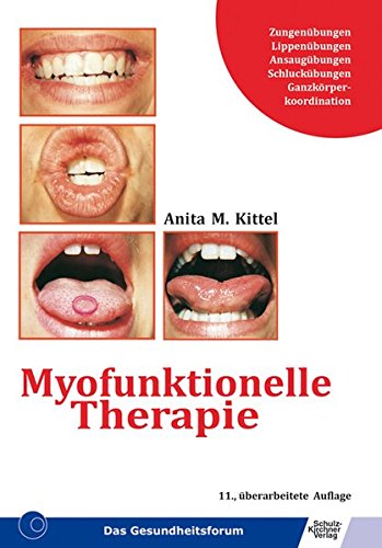 Myofunktionelle Therapie Kittel Anita M 9783824804009 Amazon Com Books