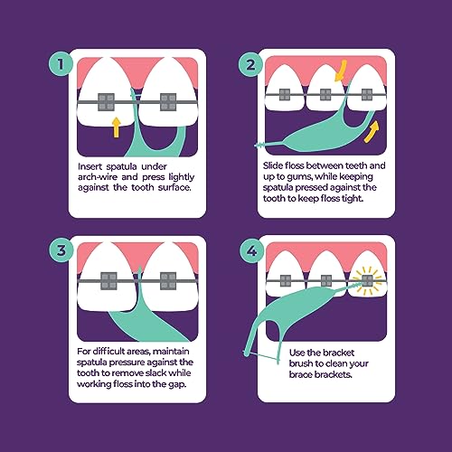 Platypus Orthodontic Flossers - Fights Bad Breath - Picks for Braces, Fits Under Arch Wire, Will Not Cause Damage - Vegan and Biodegradable - Unflavored and Shred Resistant - 30 Count
