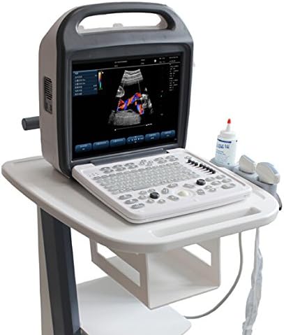 Ultrasound Color Doppler Portable Device one convex probe