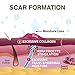 Xeragel 100% Silicone Scar Treatment Ointment 10g – Scar Gel for Smoother, Flatter Scars from Surgery, Burns, Acne & More - For Old & New Scars on Face, Neck & Hands - Hypoallergenic & Fragrance-free
