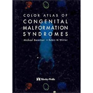 Color Atlas of Congenital Malformations