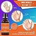 Wart Removal, Penetrates and Removes Common and Plantar Warts, Wart Remover Liquid, Plantar Warts Treatment