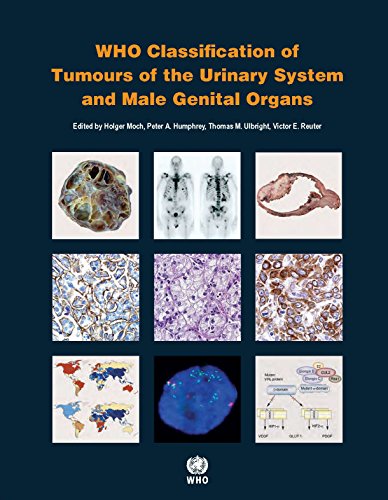 WHO Classification Of Tumours Of The Urinary System And Male Genital Organs (Medicine)