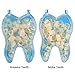 Dental Ultra-Thin Whitening Veneers Resin Teeth Upper Anterior Shade 100 PIECE