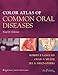 Color Atlas of Common Oral Diseases