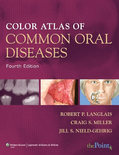 Download Color Atlas of Common Oral Diseases (English Edition) PDF