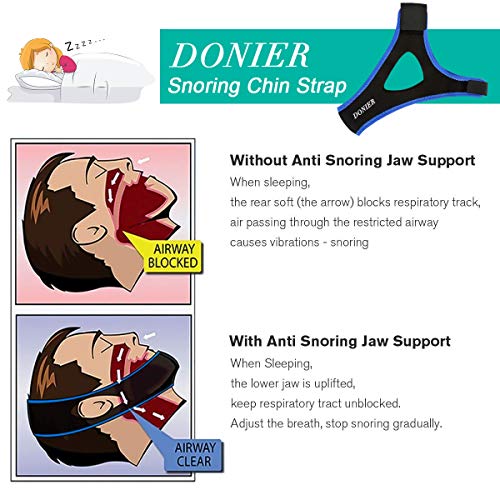 Anti Snoring Devices Chin Strap [Upgraded 2019], Snoring Solution Snore Stopper Anti Snoring Chin Strap for CPAP Users, Anti Snoring Devices Stop Snoring Sleep Aid Snore Reducing Aids for Men Women - Thumbnail 6