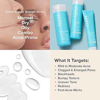 paula's choice acne set