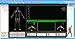 Quantum Magnetic Health Analyzer with Report Both English & Spanish Version Software for Win 7/8/10