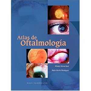 Atlas de Oftalmologia (Spanish Edition)