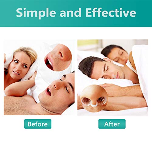 Snoring Solution-Anti Snoring Devices for Peace and Mind ! Medical Grade Nasal DilatorsI -Instanly Started Up to 50% Airflow-8 Pack Nose Vents Sleep Aid kit,Crystal - Thumbnail 3