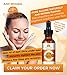 Vitamin C Serum, SALE Beauty Products for Anti Aging Skin Care - Contains Organic Vitamins C & E with Hyaluronic Acid Serum & Collagen - Get Rid of Age Spots & Dark Circles Under Eyes