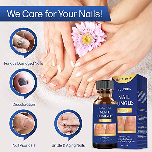 Nail Fungus Treatment Perfect for Both Toenails and Fingernails, for