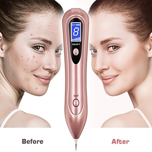Mole Removal Pen, Portable USB Charging Skin Tag Remover Freckles Dark Spot Nevus Tattoo Dot Mole Remover, LCD Display &amp; 8 Gears Adjustable Power by Stanbow