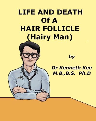 Life And Death of A Hair Follicle (Hairy Man) (A Simple Guide to Medical Conditions)