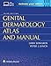 Genital Dermatology Atlas and Manual