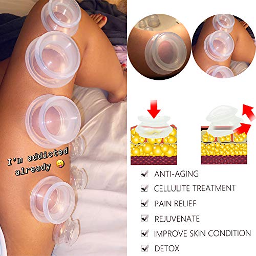 4 Sizes Cupping Therapy Set-Professional Cupping Therapy Studio and Household Silicone Cupping Set, Stronger Suction… - Image 3