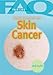 Frequently Asked Questions About Skin Cancer (FAQ: Teen Life, 3)