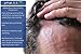 pHat 5.5 - Seborrheic Dermatitis Shampoo and Conditioner Set