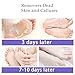 BRITOR foot peel mask, Exfoliating Dead Skin Remover– 2 pair