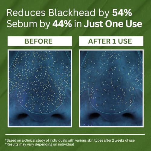 LBOYLOVE® Holy Basil Bubble Deep Mask – Holy Basil & Carbonated Water for Cleansing Pores & Blackheads, Korean Clay to Bubble Wash-Off Pack (90g / 3.17 oz)
