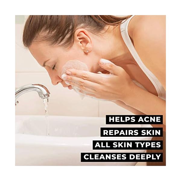 O-Naturals-6-Piece-Green-Tea-Herbal-Essential-oils-Bar-Soap-Collection-Moisturizing-Face-Body-Cleanser-Anti-Acne-Aromatherapy-Gift-Set-Vegan-Organic-Ingredients-Shea-Butter-Men-Women-680gr-Total O Naturals 6-Piece Green Tea Herbal Essential oils Bar Soap Collection Moisturizing Face & Body Cleanser Anti Acne…