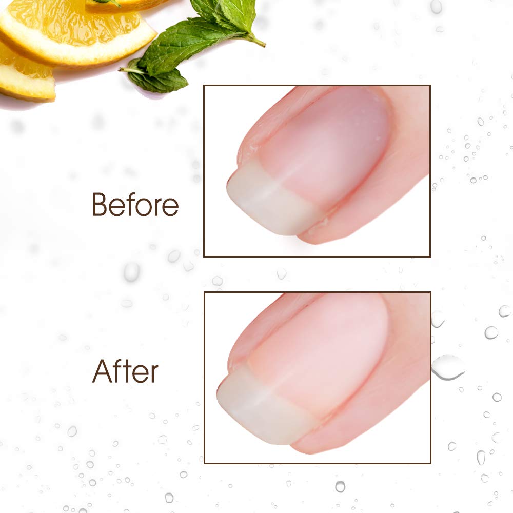 Gena Nail Brite Whitening Scrub with Brush, Cleans Conditions & Brightens Nails, 4 oz: Beauty
