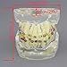 Smile1000 Dental Malocclusion Orthodontic Treatment Teeth Model with Metal Brackets Wires Colorful Ties Chains and Hoops M3005