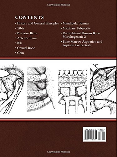 Atlas of Oral and Extraoral Bone Harvesting - //medicalbooks.filipinodoctors.org