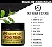 Medicine Man’s Wonder Balm – All Purpose Healing Ointment 2 oz – Natural Formula for Itchy, Scaly or Cracked Skin – Good as Fungus Infection Treatment, Skin Rash Cream, Psoriasis, Athletes Foot Carethumb 1
