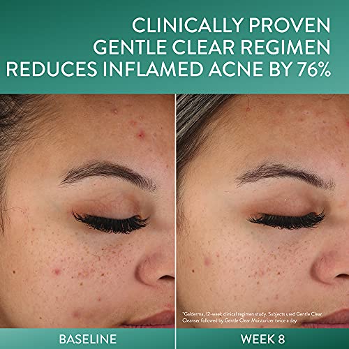 Cetaphil Face Moisturizer, Gentle Clear Mattifying Acne Moisturizer