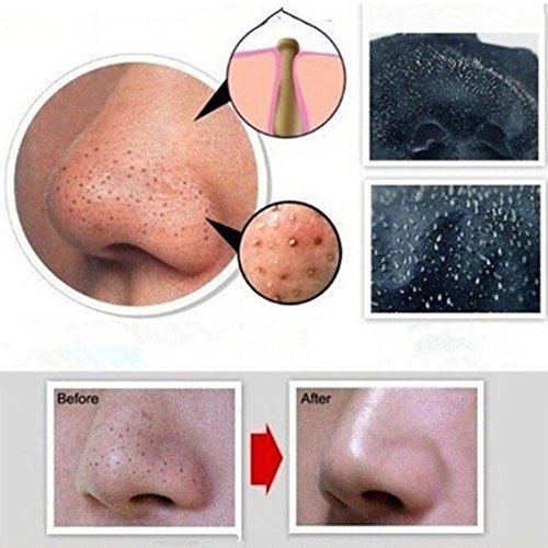 Hunputa Blackhead Purifying Peel Off Mask,Activated Charcoal Blackhead Exfoliators Remover Clear Mask Black Mud Pore Removal Strip Mask For Face Nose Acne Treatment