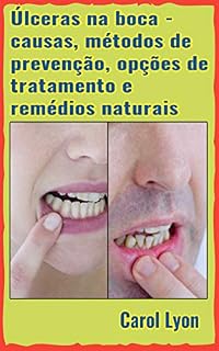 Livro Úlceras na boca - causas, métodos de prevenção, opções de tratamento e remédios naturais