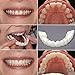 5Pc Cosmetic Upper Teeth, Iuhan Temporary Smile Comfort Fit Cosmetic Teeth Denture Teeth Top Cosmetic Veneer (White)