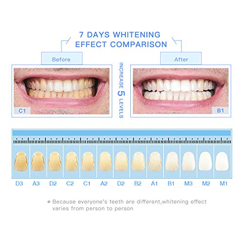 Teeth Whitening Pen Kit(5 Pens), Safe 35 Carbamide Peroxide Gel