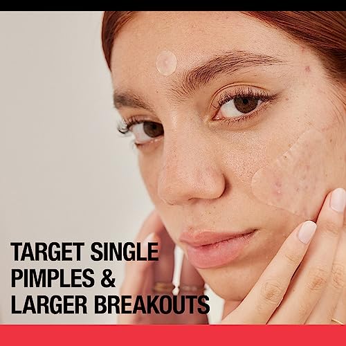 NEUTROGENA STUBBORN ACNE BLEMISH PATCHES COMBINATION PACK, ULTRA-THIN HYDROCOLLOID ACNE PATCH ABSORBS FLUIDS & REMOVES IMPURITIES TO HELP PIMPLES LOOK SMALLER, 2 SIZES, 16 PATCHES