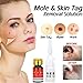 HELLOYOUNG Mole & Tag Removal Solution Mole Dark Spot Removal Wart Tag Freckle Removal Cream Oil PlasterOintmentsthumb 3