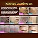 LanBeNa Acne Scar Mark Removal Gel Ointment, 30g (1.05oz) .