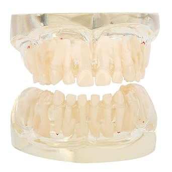 Download Amazon Com Dental Teeth Model Demonstration Teeth Model HD Get Wallpaper Amazon Com Dental Teeth Model Demonstration Teeth Model Desktop Wallpaper