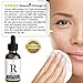 NEW 2018 Retinol serum 2.5% - BEST Face Serum with Hyaluronic Acid Vitamin E Vitamin A Aloe Vera - Anti Aging Serum Reduce Wrinkles Fine Lines Age Spots Sun Damage - Anti Wrinkle Facial Serum