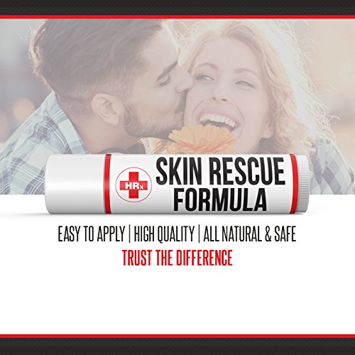 Skin Rescue Formula (*Herp Stop Discreet) Shingles, Herpes, Cold Sores. Quickly Soothe, Relieve Pain - //coolthings.us