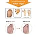 Bunion Corrector - Hinged Bunion Splint & Bunion Relief Protector Kit - Gel Toe Separators Spacers Straighteners Relieve Hallux Valgus,Tailors Bunion,Big Toe Joint,Hammer Toe